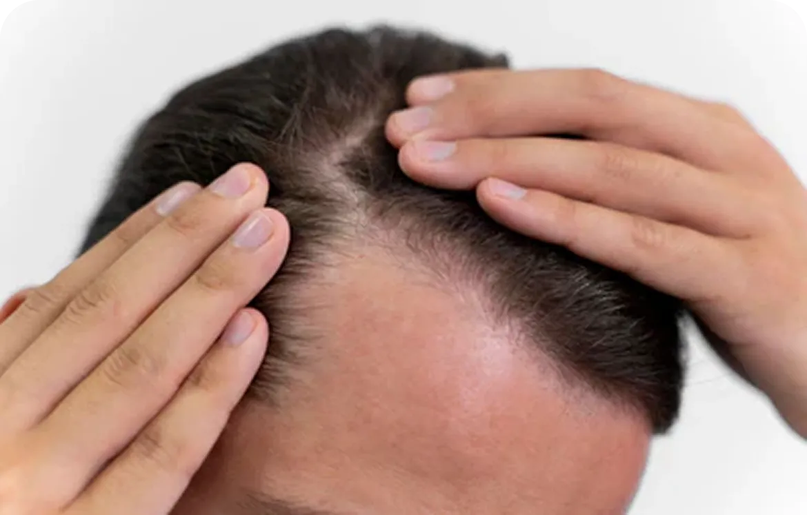 Sesame Oil for Hair: 8 Benefits and How to Use It