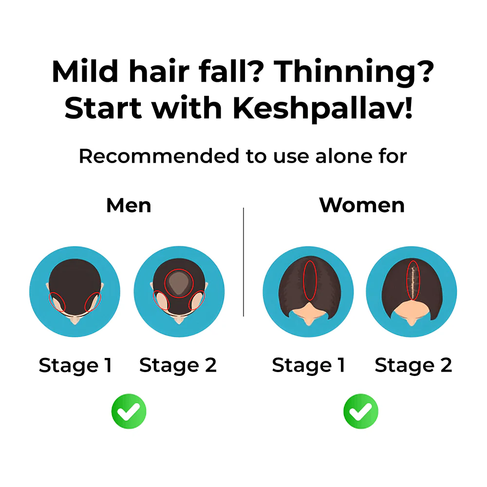 Keshpallav Hair Oil for Stage 1 & 2 Hair Loss